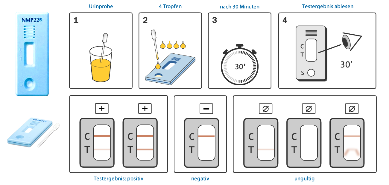 NMP22 BladderChek - Anwendungschema